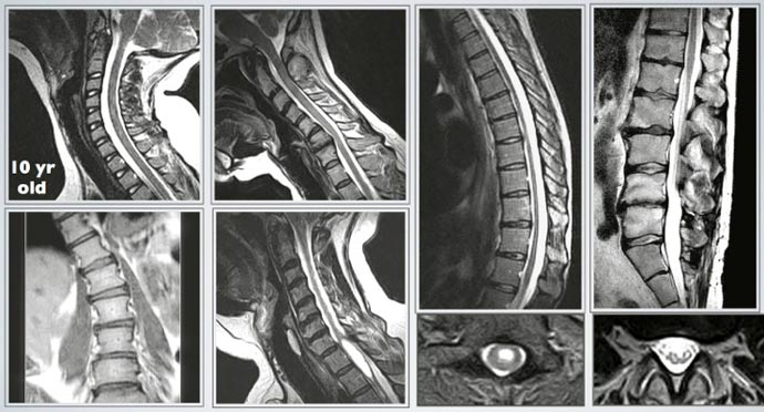 spine imaging